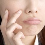 コーヒーとニキビの無視できない関係~コーヒーの美肌効果